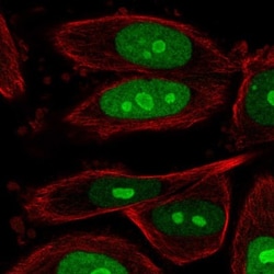 BOP1 Antibody, Novus Biologicals:Antibodies:Primary Antibodies